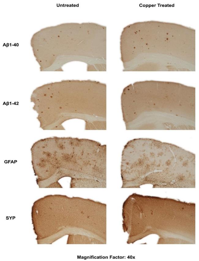 beta Amyloid (1-42) Antibody in Immunohistochemistry (PFA fixed) (IHC (PFA))