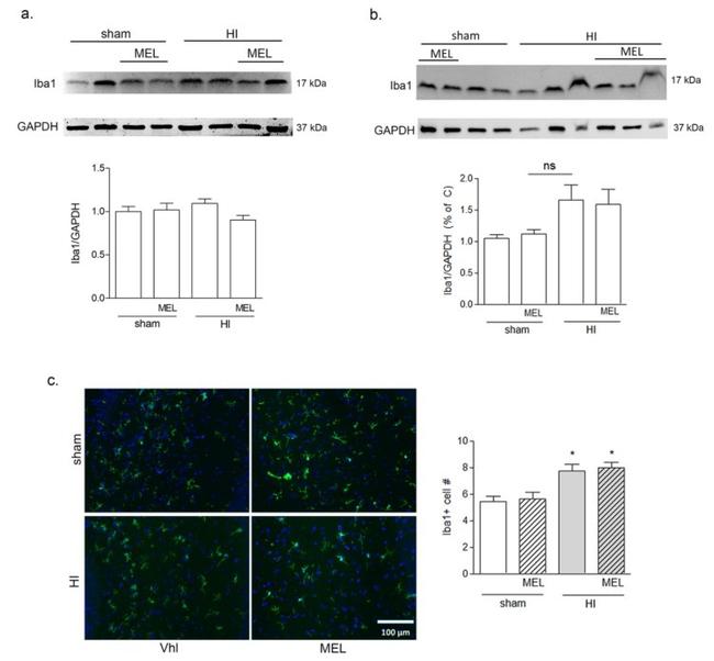 IBA1 Antibody in Immunohistochemistry (IHC)