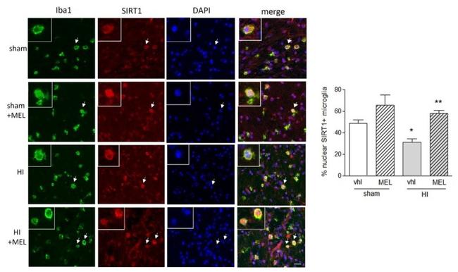 IBA1 Antibody in Immunohistochemistry (IHC)