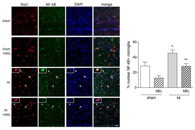 IBA1 Antibody in Immunohistochemistry (IHC)