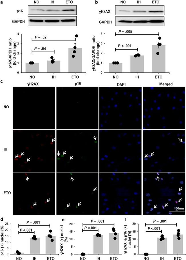 p16INK4a Antibody in Immunocytochemistry (ICC/IF)