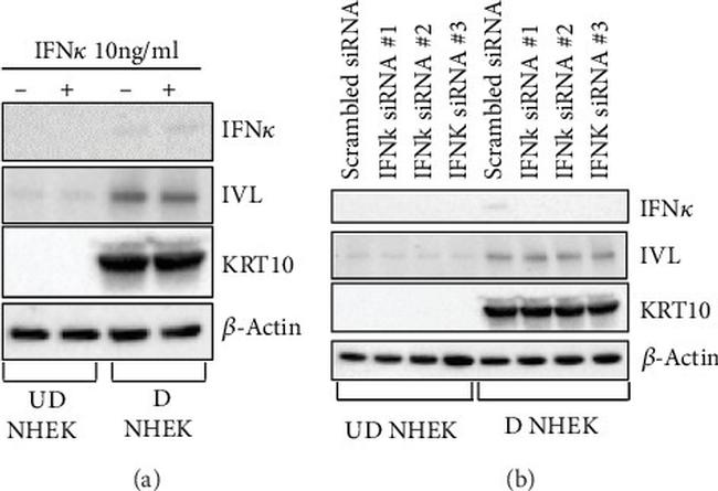 Involucrin Antibody in Western Blot (WB)