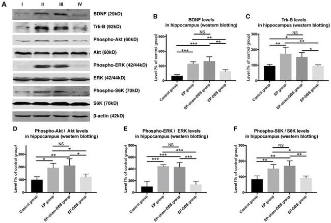 Phospho-p70 S6 Kinase (Thr421, Ser424) Antibody in Western Blot (WB)