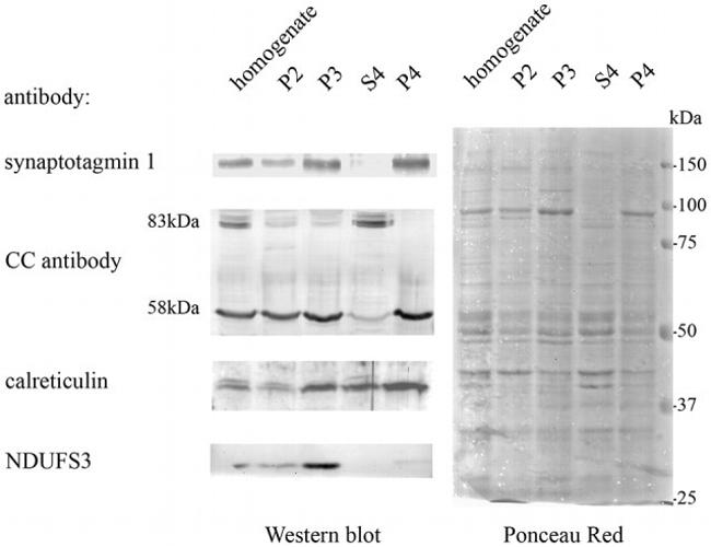 Calsequestrin Antibody in Western Blot (WB)