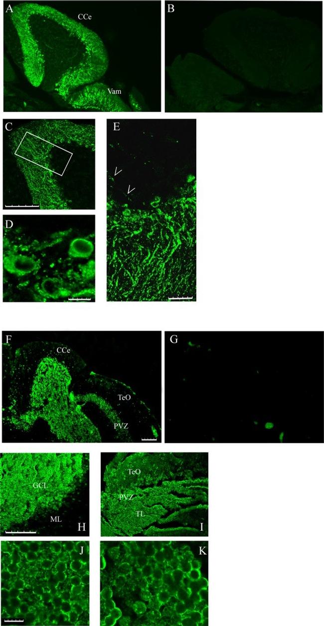 Calsequestrin Antibody in Immunohistochemistry (Paraffin) (IHC (P))