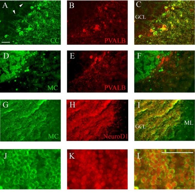 Calsequestrin Antibody in Immunohistochemistry (Paraffin) (IHC (P))