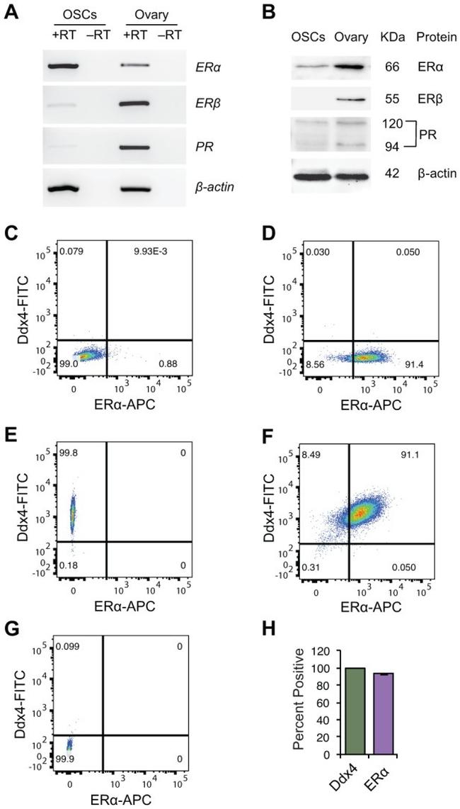 Estrogen Receptor beta Antibody in Western Blot (WB)