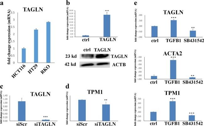 TAGLN Antibody in Western Blot (WB)