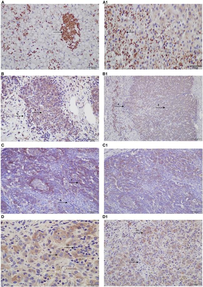 CX3CR1 Antibody in Immunohistochemistry (IHC)