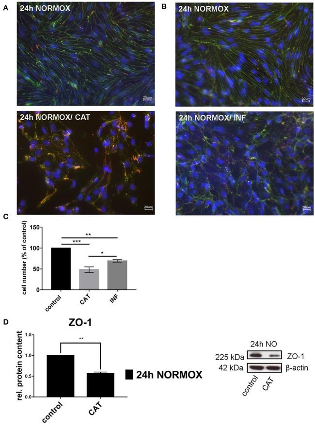 Claudin 5 Antibody in Immunocytochemistry (ICC/IF)