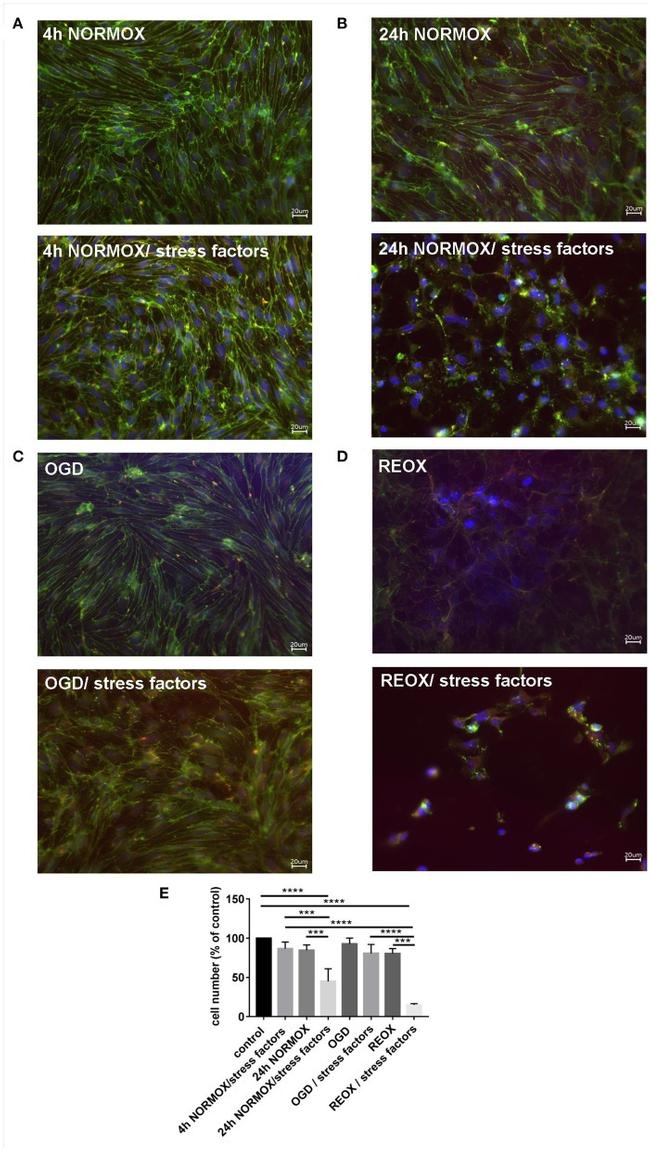 Claudin 5 Antibody in Immunocytochemistry (ICC/IF)