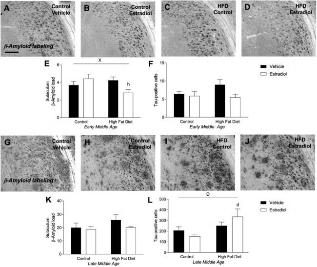 beta Amyloid Antibody in Immunohistochemistry (IHC)