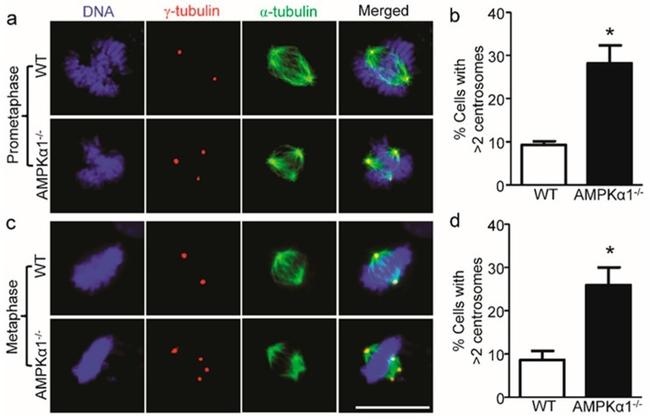 gamma Tubulin Antibody in Immunocytochemistry (ICC/IF)