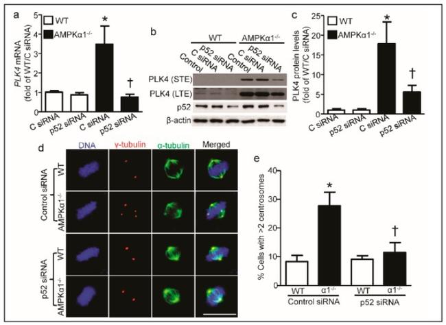 gamma Tubulin Antibody in Immunocytochemistry (ICC/IF)