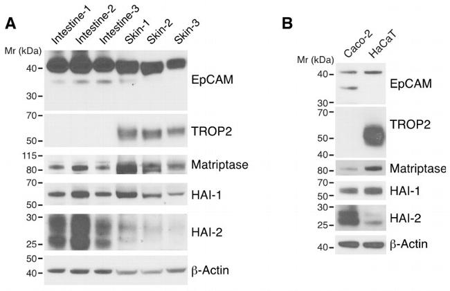 EpCAM Antibody in Western Blot (WB)