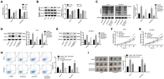 O-linked N-acetylglucosamine (O-GlcNAc) Antibody in Western Blot (WB)