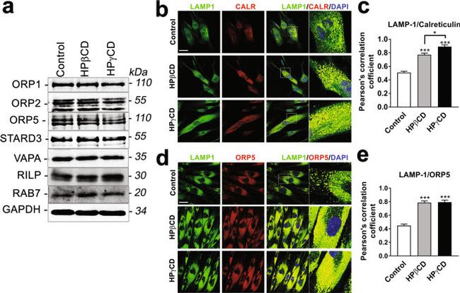 ORP5 Antibody in Immunocytochemistry (ICC/IF)