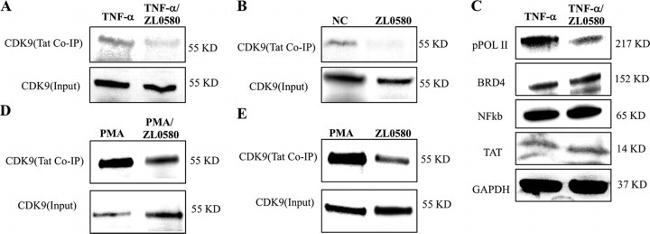 CDK9 Antibody in Western Blot, Immunoprecipitation (WB, IP)