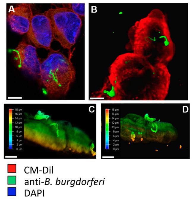 Borrelia burgdorferi Antibody in Immunocytochemistry (ICC/IF)