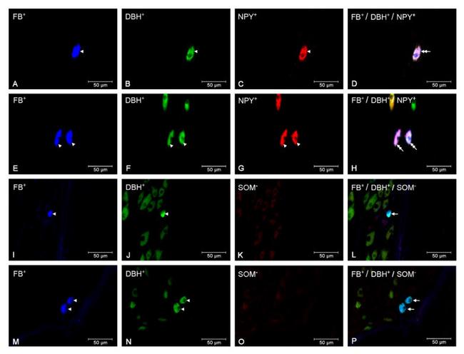 NPY Antibody in Immunohistochemistry (IHC)