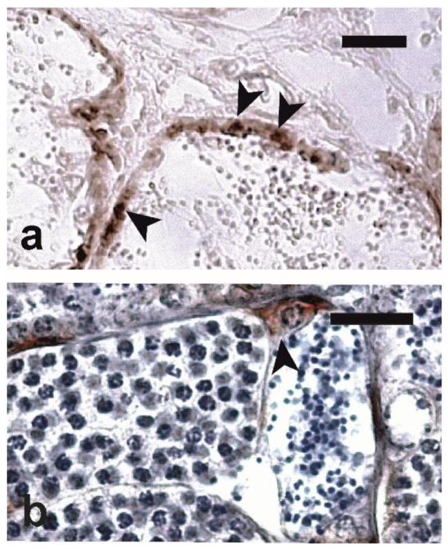 OCT4 Antibody in Immunohistochemistry (IHC)