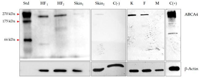 ABCA4 Antibody in Western Blot (WB)