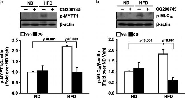 Phospho-MYL9 (Thr18, Ser19) Antibody in Western Blot (WB)