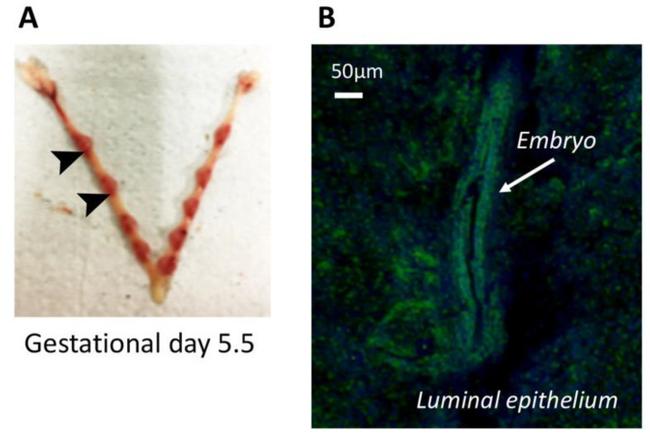 Annexin A1 Antibody in Immunocytochemistry (ICC/IF)