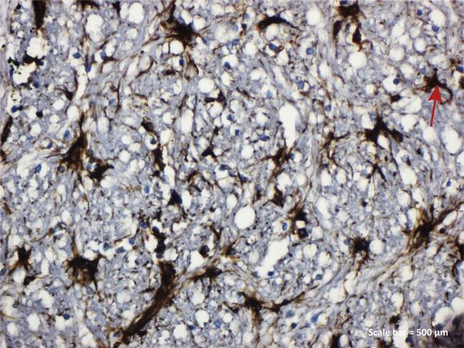 GFAP Antibody in Immunohistochemistry (IHC)