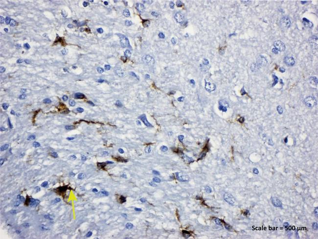 GFAP Antibody in Immunohistochemistry (IHC)