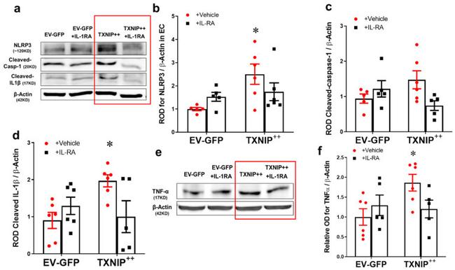 TXNIP Antibody in Western Blot (WB)