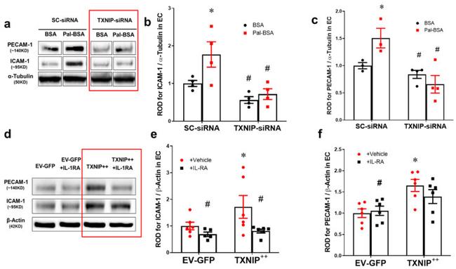 TXNIP Antibody in Western Blot (WB)