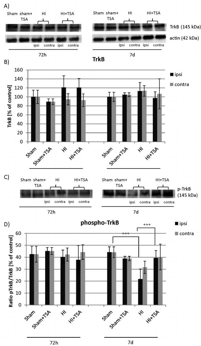 Phospho-TrkB (Tyr516) Antibody in Western Blot (WB)