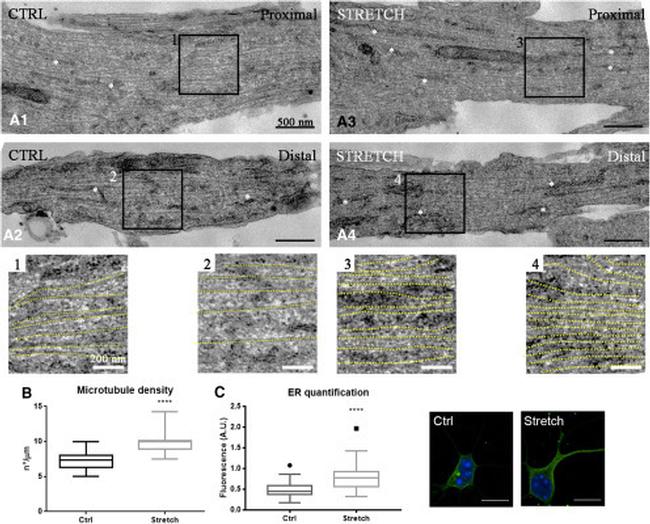 KDEL Antibody in Immunohistochemistry (IHC)