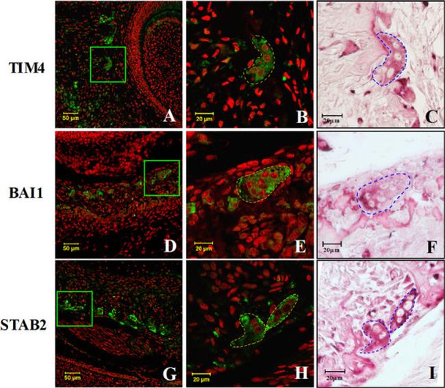 BAI1 Antibody in Immunohistochemistry (IHC)