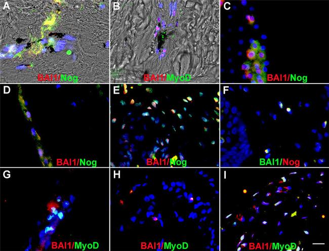 MYOD Antibody in Immunohistochemistry (IHC)