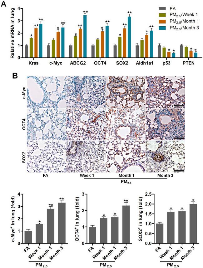 SOX2 Antibody in Immunohistochemistry (IHC)