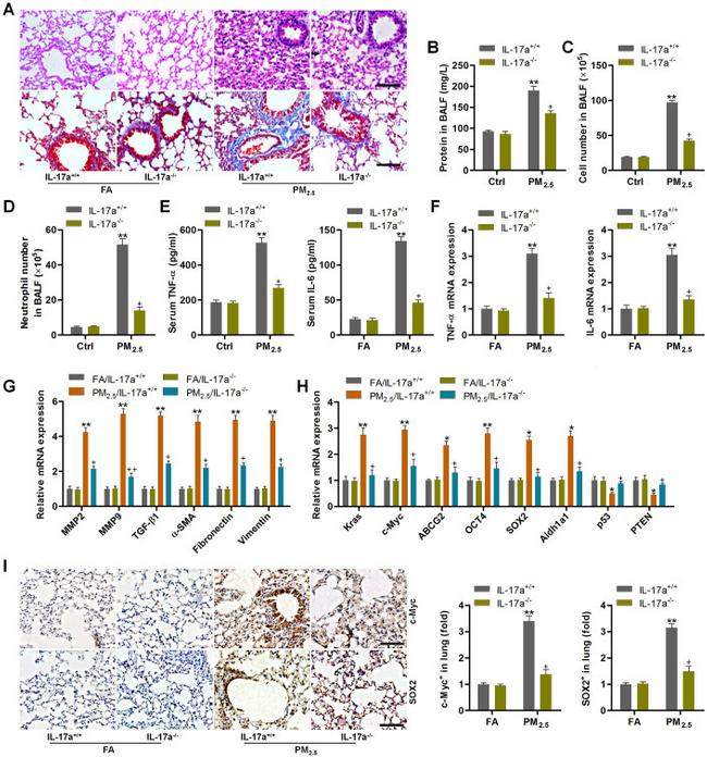 SOX2 Antibody in Immunohistochemistry (IHC)