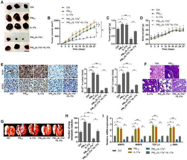 SOX2 Antibody in Immunohistochemistry (IHC)