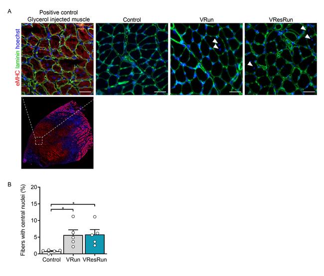 Laminin Antibody in Immunohistochemistry (IHC)