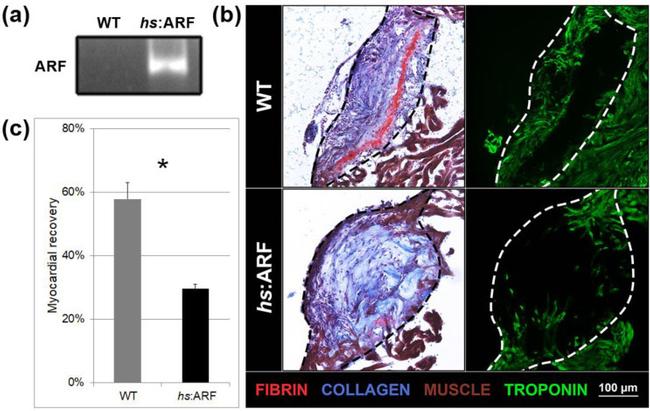 Cardiac Troponin T Antibody in Immunohistochemistry (IHC)