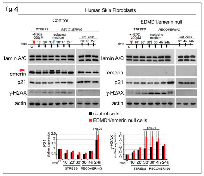 p21 Antibody in Western Blot (WB)