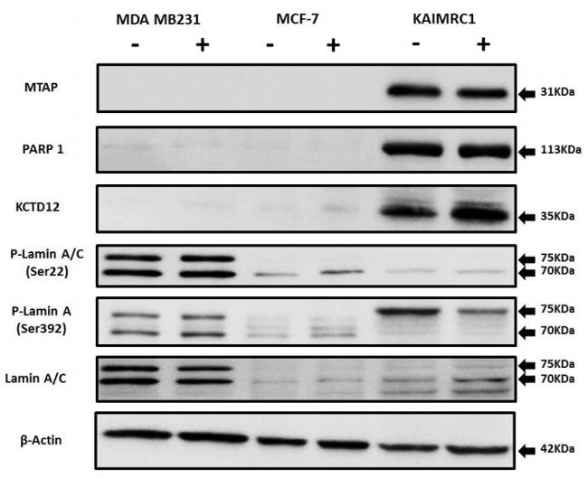 KCTD12 Antibody in Western Blot (WB)