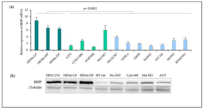 PEBP1 Antibody in Western Blot (WB)