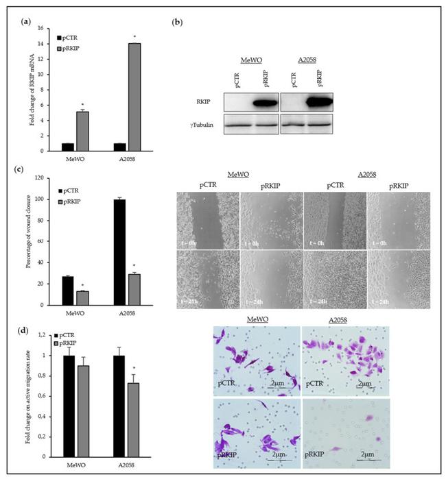 PEBP1 Antibody in Western Blot (WB)