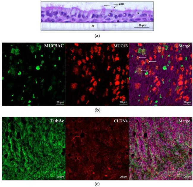 MUC5AC Antibody in Immunohistochemistry (IHC)