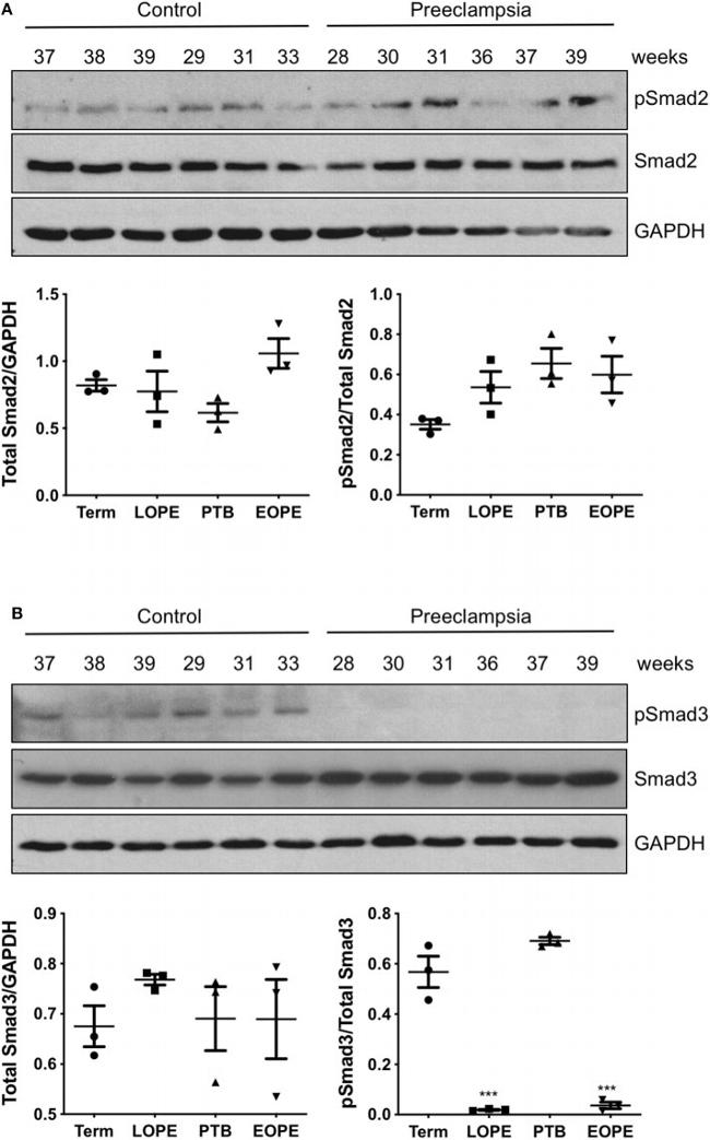 Phospho-SMAD2 (Ser465, Ser467) Antibody in Western Blot (WB)