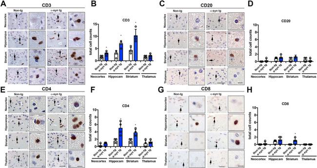 CD20 Antibody in Immunohistochemistry (IHC)