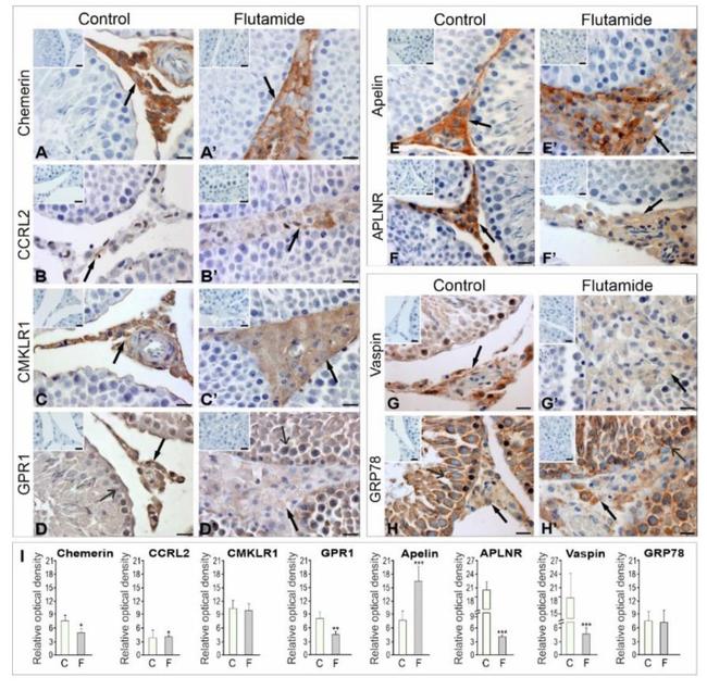 SERPINA12 Antibody in Immunohistochemistry (IHC)