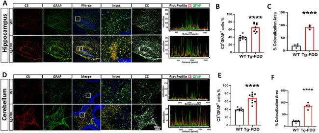 Complement C3 Antibody in Immunohistochemistry (IHC)